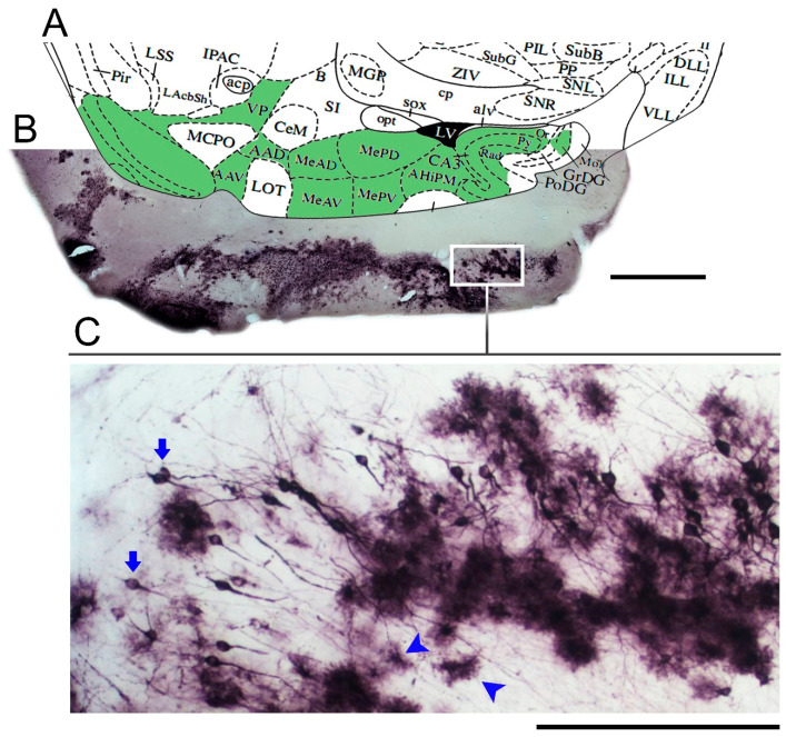 An external file that holds a picture, illustration, etc.
Object name is brainsci-11-01009-g001.jpg