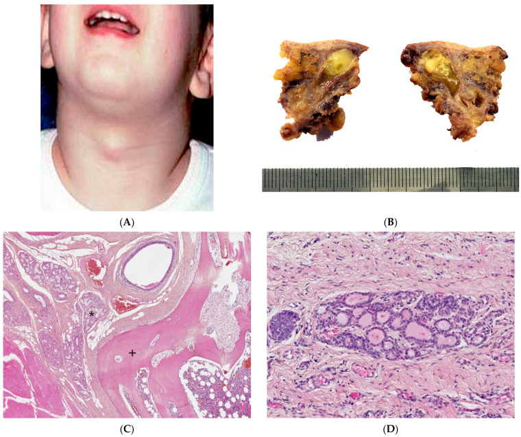 An external file that holds a picture, illustration, etc.
Object name is dermatopathology-08-00039-g002.jpg