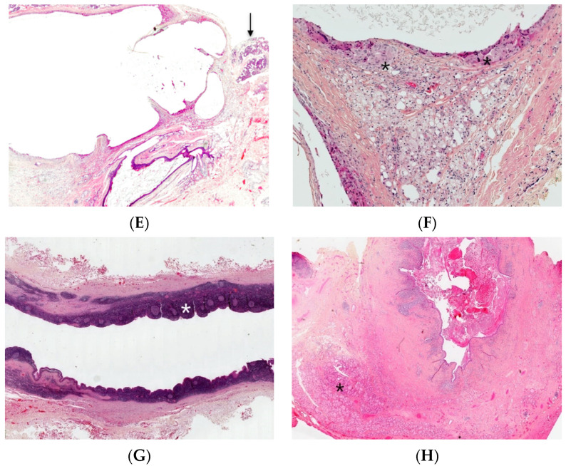 An external file that holds a picture, illustration, etc.
Object name is dermatopathology-08-00039-g003b.jpg