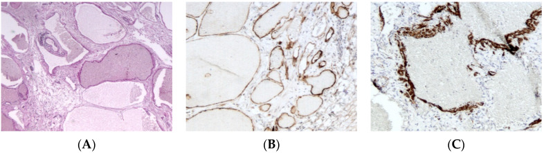 An external file that holds a picture, illustration, etc.
Object name is dermatopathology-08-00039-g004.jpg