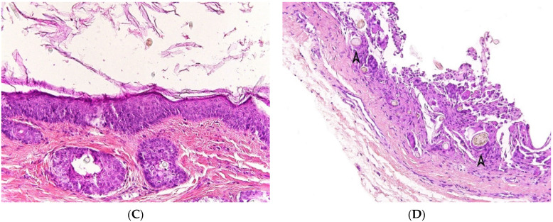 An external file that holds a picture, illustration, etc.
Object name is dermatopathology-08-00039-g005b.jpg