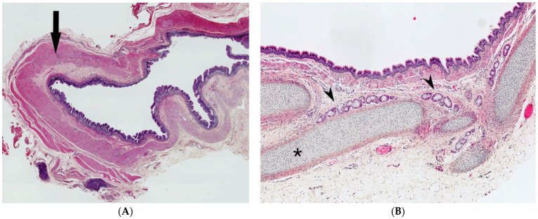 An external file that holds a picture, illustration, etc.
Object name is dermatopathology-08-00039-g007.jpg