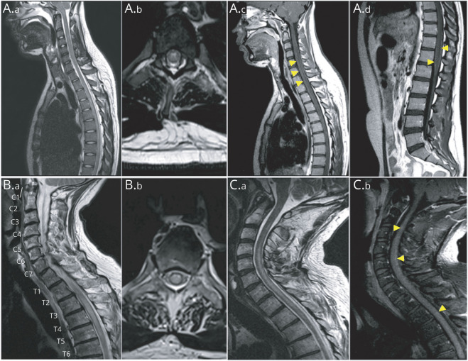 An external file that holds a picture, illustration, etc.
Object name is NEUROLOGY2021172684F3.jpg