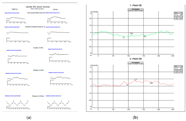 An external file that holds a picture, illustration, etc.
Object name is genes-13-01005-g002.jpg