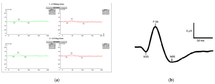 An external file that holds a picture, illustration, etc.
Object name is genes-13-01005-g006.jpg