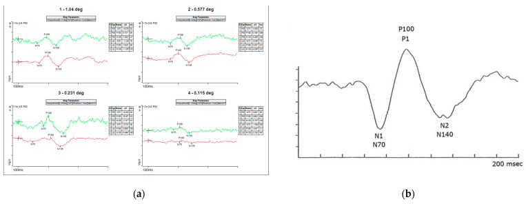 An external file that holds a picture, illustration, etc.
Object name is genes-13-01005-g007.jpg