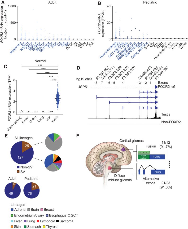 Figure 1. FOXR2 is aberrantly expressed across adult and pediatric cancers through multiple mechanisms. A, FOXR2 mRNA expression log2(normalized count + 1) generated by RSEM of all TCGA samples across cancer subtypes (n = 8,391). Mean expression for each cancer subtype indicated by a black horizontal line. Cancer subtypes labeled blue indicates mean FOXR2 expression   0.1. Cancer subtypes with abbreviations: melanoma (n = 443), EC = endometrial cancer (n = 230), NSGCT = nonseminomatous germ cell tumor (n = 86), CSCC = cervical squamous cell carcinoma (n = 248), NSCLC = non small cell lung cancer (n = 994), HNSCC = head and neck squamous cell carcinoma (n = 515), RNCCC = renal nonclear cell carcinoma (n = 348), sarcoma (n = 253), BUC = bladder urothelial carcinoma (n = 407), HCC = hepatocellular carcinoma (n = 363), CA = colorectal adenocarcinoma (n = 365), DG = diffuse glioma (n = 513), IBC = invasive breast carcinoma (n = 1,082), RCCC = renal clear cell carcinoma (n = 510), PA = pancreatic adenocarcinoma (n = 177), CeA = cervical adenocarcinoma (n = 46), GBM = glioblastoma (n = 160), AC = adrenocortical carcinoma (n = 78), PrA = prostate adenocarcinoma (n = 460). Black dotted line indicates log2(normalized count + 1)   1. B, FOXR2 mRNA expression FPKM scores across pediatric cancer subtypes within the INFORM data set (n = 1,279). Mean expression for each cancer subtype indicated by black horizontal line. Cancer subtypes labeled blue indicates mean FOXR2 expression   1.0. Cancer subtypes with abbreviations: neuroblastoma (n = 162), HGG = high-grade glioma (n = 209), GCT non-CNS = germ cell tumor, noncentral nervous system (n = 21), GCT CNS = germ cell tumor, central nervous system (n = 9), osteosarcoma (n = 137), medulloblastoma (n = 66), ependymoma (n = 92), RMS = rhabdomyosarcoma (n = 181), Ewing sarcoma (n = 147), B-ALL = B-lymphoblastic leukemia (n = 64), ACC = adrenocortical carcinoma (n = 8), AML = acute myeloid leukemia (n = 34), ATRT = atypical teratoid rhabdoid tumor (n = 21), HCC = hepatocellular carcinoma (n = 13), hepatoblastoma (n = 14), T-ALL = T-lymphoblastic leukemia (n = 16), ETMR = embryonal tumor with multilayered rosettes (n = 13), NHL = non-Hodgkin lymphoma (n = 28), Wilms tumor (n = 44). Black dotted line indicates FPKM   0. C, Normal postnatal expression of FOXR2 from the GTEx data set. Mean and individual TPM values displayed. ***, P   0.0001 (Tukey multiple comparisons test). Lineages include the following: brain (Cortex; n = 255), breast (n = 459), colon (n = 779), lung (n = 578), skin (n = 1,304), testis (n = 361). D, FOXR2 isoforms identified in normal testis which harbor additional exons to the single exon annotated in RefSeq (Exon +1). The position of each additional exon is shown, with the corresponding annotation used throughout this manuscript to refer to each of them: Exon  1, Exon  2, Exon  3, Exon  4, Exon  5, Exon  6, and Exon  7. Aligned reads from a non FOXR2-expressing glioma are shown as a negative control. E, The proportion of FOXR2-expressing tumors identified to harbor structural variants (SV) across 152 tumors encompassing all adult and pediatric lineages. Also shown are the different lineages represented in SV and non-SV FOXR2-expressing tumors. F, Fraction and percentage of tumors within each brain location shown that harbor SVs or aberrant promoters to activate FOXR2. SVs are enriched in cortical tumors whereas midline gliomas tend to activate FOXR2 through the use of aberrant promoters. ****, P   0.0001 as determined by Fisher exact test for mutual exclusivity.