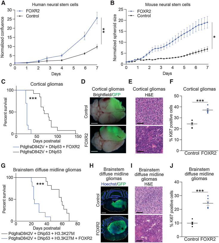 Figure 4. FOXR2 is sufficient in vitro and in vivo to promote proliferation and tumor formation. A, Normalized confluence of H9 human neural stem cells (hNSC) expressing FOXR2 relative to control. Values indicate mean   SEM across three replicate experiments. **, P   0.01 as determined by a two-tailed unpaired t test on day 7. B, Normalized spheroid size (relative to day 0) of mNSCs transduced with lentiviral vectors to induce expression of FOXR2 or vector control. Values indicate mean   SEM across three replicate experiments. *, P   0.05 as determined by a two-tailed unpaired t test on day 7. C, Survival curves of control (n = 13) and FOXR2-expressing (n = 10) IUE pediatric high-grade glioma (pHGG; PdgfraD842V + DNp53) mouse models. ***, P   0.0001 as determined by the log-rank Mantel Cox test. D, Representative whole-brain images of control and FOXR2-expressing IUE pHGG (PdgfraD842V + DNp53) mouse models. GFP expression indicates the cortical location of IUE-targeted pHGG models. Scale bar = 1 mm. E, Representative H E staining of control and FOXR2-expressing IUE cortical gliomas. Scale bar = 100  m. F, Percentage of Ki67-positive cells in tumors collected from control or FOXR2-expressing IUE cortical gliomas. Values indicate mean   SEM from tumors obtained from six mice per condition. ***, P   0.0001 as determined by a two-tailed unpaired t test. G, Survival curves of control (n = 11) and FOXR2-expressing (n = 10) IUE brainstem DMG (PdgfraD842V + DNp53 + H3.3K27M) mouse models. ***, P   0.0001 as determined by log-rank Mantel Cox test. H, Representative images of control and FOXR2-expressing IUE brainstem DMG models labeled with GFP (green) and counterstained with Hoechst (blue). GFP expression indicates the brainstem location of IUE-targeted DMG models. Hoechst stains nuclei as a marker of all cells. I, Representative H E staining of control and FOXR2-expressing IUE brainstem DMG models. Scale bar = 100  m. J, Percentage of Ki67-positive cells in tumors collected from control or FOXR2-expressing IUE brainstem DMG models. Values indicate mean   SEM from tumors obtained from six mice per condition. ***, P   0.0001 as determined by a two-tailed unpaired t test.