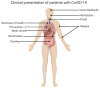 Clinical Presentation of Patients with CoVID-19 Contributed by Rohan Bir Singh, MD; Made with Biorender