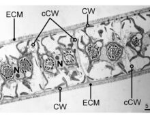 Close-up microscope image of connected algae cells. Each cell has a dark spot (nucleus) and circular structures. The cells are separated by thin walls and surrounded by a thick outer layer.