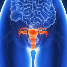 Ovarian Disorders