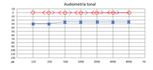 Audiometría tonal.png